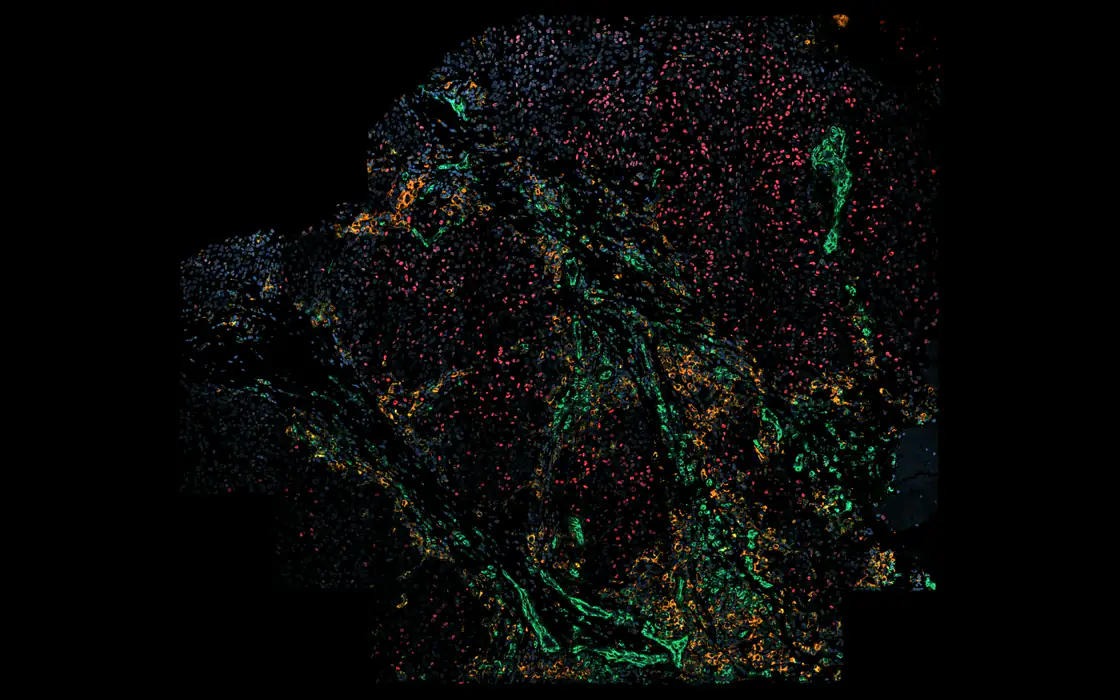 One plane of a 3-D multiplexed tissue section in Plexora, four markers shown.